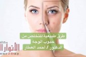 طرق طبيعية للتخلص من حبوب الوجه مع الدكتور / أحمد العطار