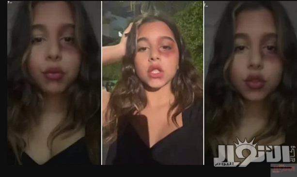 ابنة شيرين عبد الوهاب  تفاجئ الجميع بفيديو صادم.. والجمهور: «أمك فين؟»